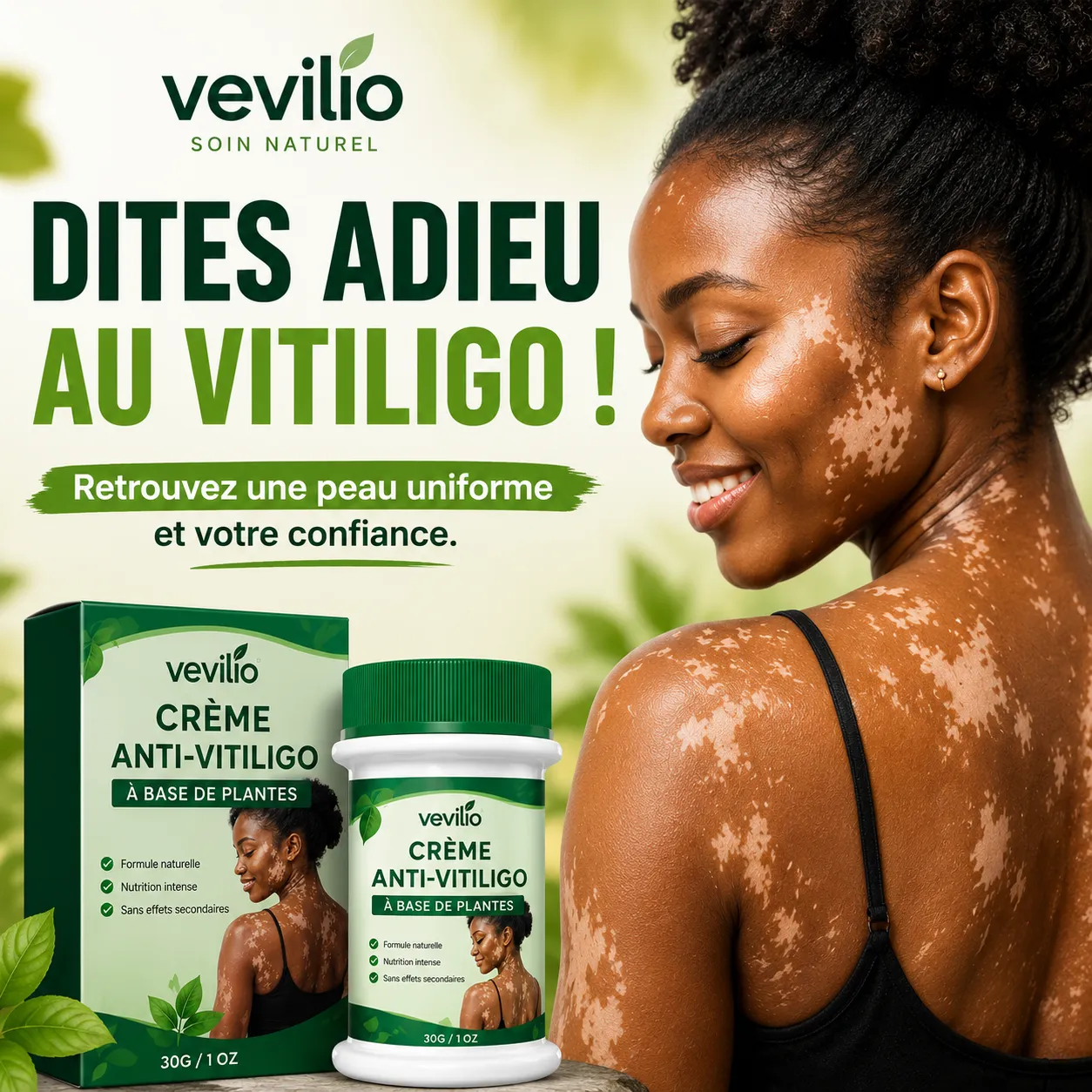 Vitiligo Cream